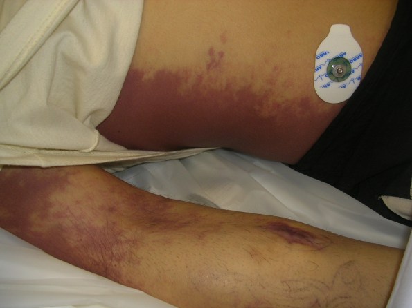 manuel-005 Il corpo di Manuel Eliantonio