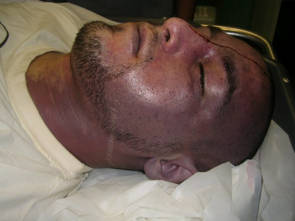 manuel-016 Il corpo di Manuel Eliantonio