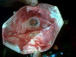 Cosa stanno tirando sui manifestanti di piazza Taksim? Perché basta respirare per avere una mascherina piena di sangue? Cosa c'è in quei lacrimogeni? Di cosa state bombardando chi protesta da venti giorni?